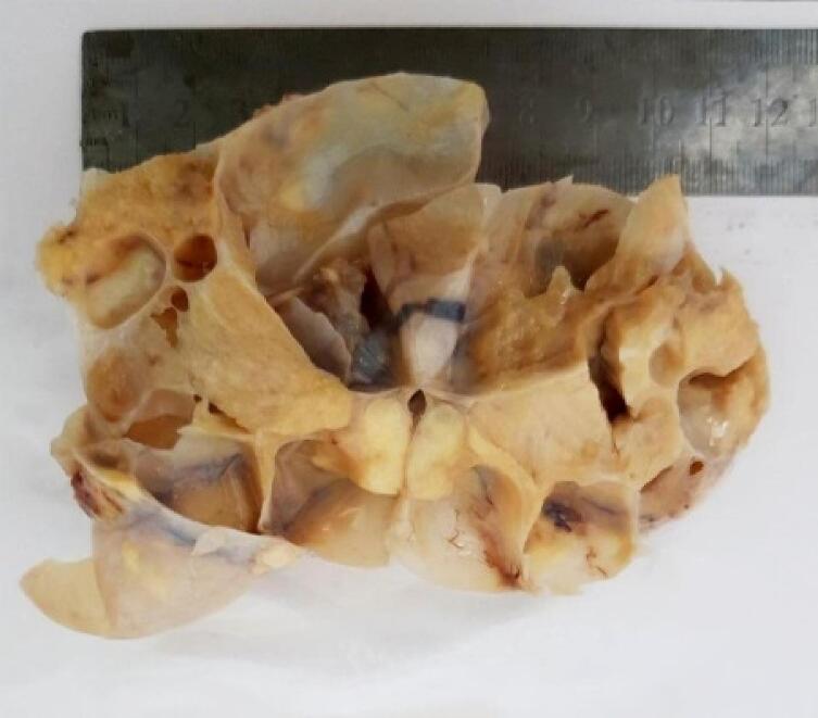 https://cdn.ncbi.nlm.nih.gov/pmc/blobs/9668/10189258/35c23814255a/gr4.jpg