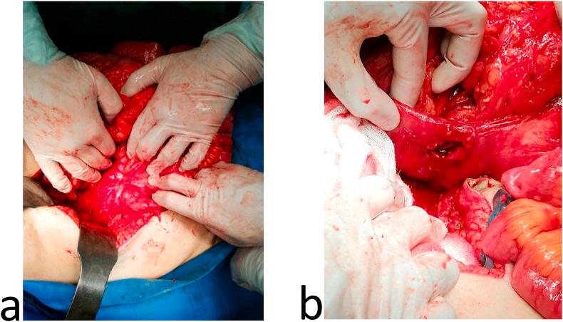 https://cdn.ncbi.nlm.nih.gov/pmc/blobs/966c/7841073/0e64cd7cc299/gr3.jpg
