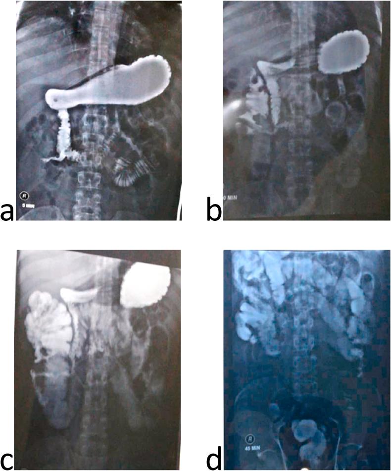 https://cdn.ncbi.nlm.nih.gov/pmc/blobs/966c/7841073/e7ce6726e877/gr1.jpg
