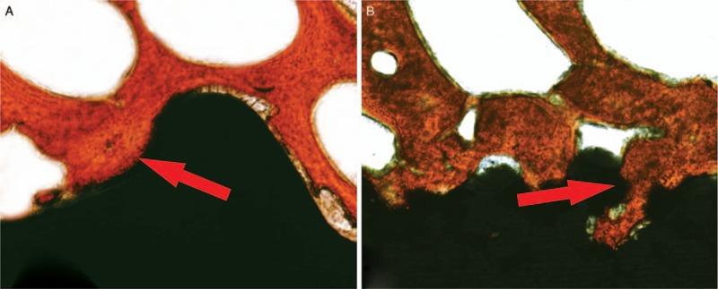 https://cdn.ncbi.nlm.nih.gov/pmc/blobs/9670/6846250/5b279a909919/cm9-132-2594-g005.jpg