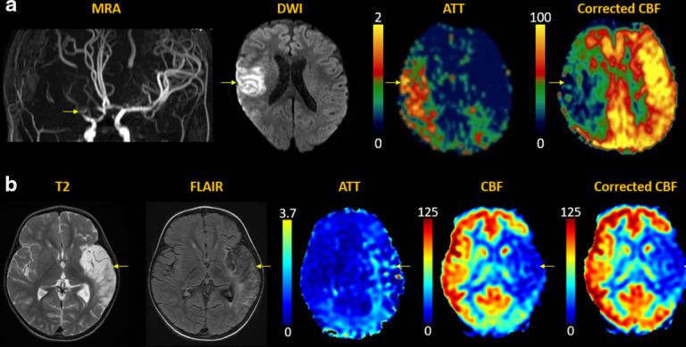 https://cdn.ncbi.nlm.nih.gov/pmc/blobs/9679/10996417/407465ca26e8/bjr.20220034.g003.jpg