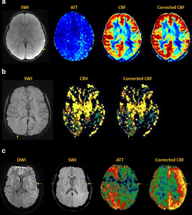 https://cdn.ncbi.nlm.nih.gov/pmc/blobs/9679/10996417/c01885f819e0/bjr.20220034.g008.jpg
