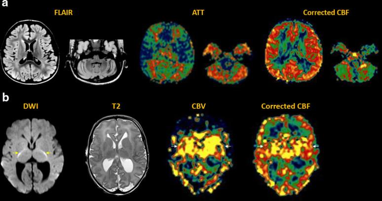 https://cdn.ncbi.nlm.nih.gov/pmc/blobs/9679/10996417/d4e40920c4d9/bjr.20220034.g013.jpg