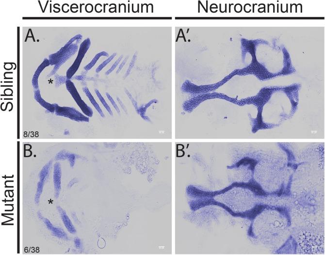 https://cdn.ncbi.nlm.nih.gov/pmc/blobs/9682/5501617/7e36d3f5a5df/pone.0180856.g001.jpg