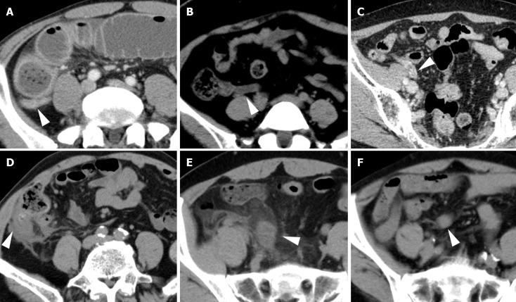 https://cdn.ncbi.nlm.nih.gov/pmc/blobs/9683/11238778/86d84c860679/WJCC-12-5217-g001.jpg
