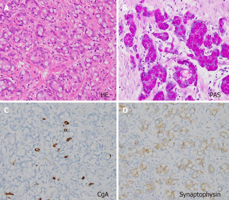 https://cdn.ncbi.nlm.nih.gov/pmc/blobs/9683/11238778/8a59a0dfc30b/WJCC-12-5217-g003.jpg