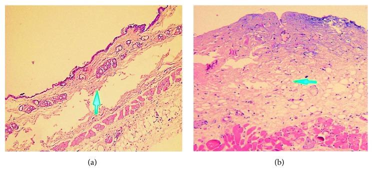 https://cdn.ncbi.nlm.nih.gov/pmc/blobs/9689/5859817/9d68b5190954/DRP2018-2730169.003.jpg