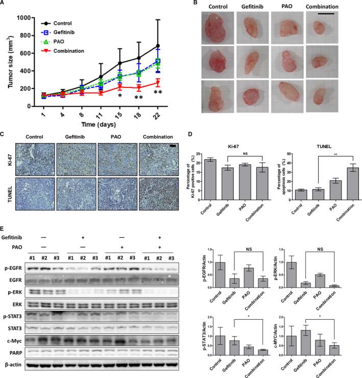 https://cdn.ncbi.nlm.nih.gov/pmc/blobs/9689/7826488/93f616bce902/CAM4-10-372-g005.jpg