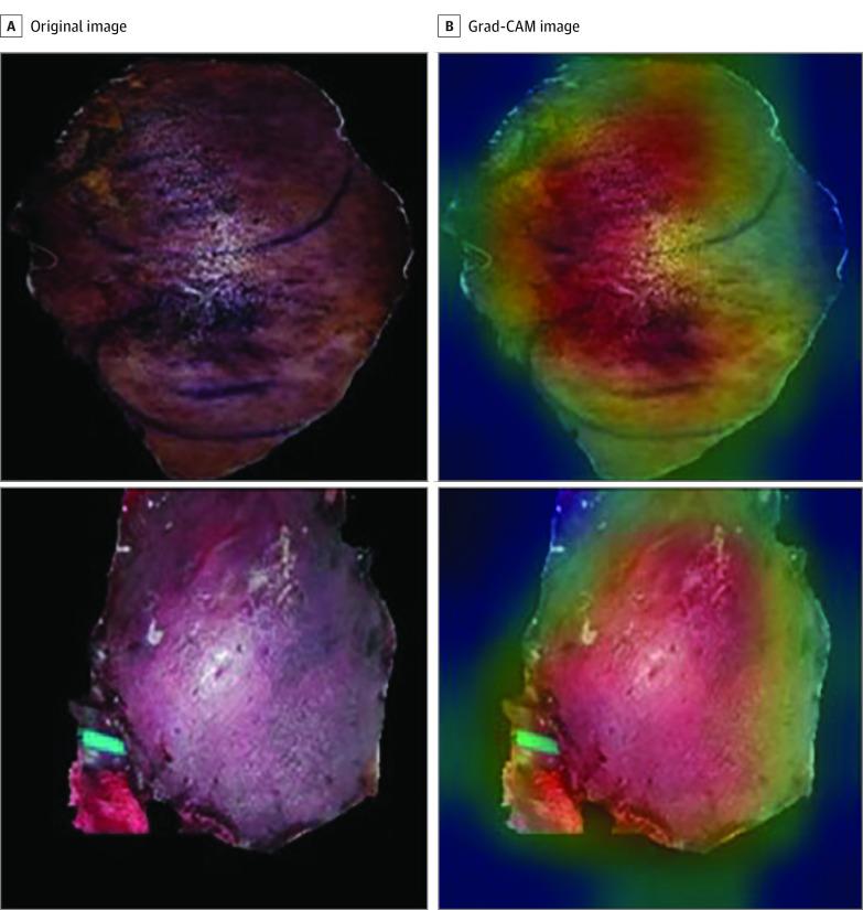 https://cdn.ncbi.nlm.nih.gov/pmc/blobs/968c/11282448/1840cab47750/jamanetwopen-e2424299-g004.jpg