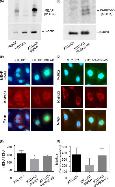 https://cdn.ncbi.nlm.nih.gov/pmc/blobs/968f/7419045/888f281dc57d/CAS-111-2814-g002.jpg