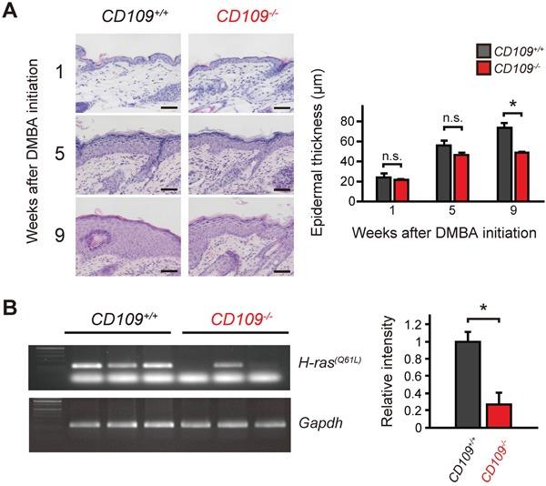 https://cdn.ncbi.nlm.nih.gov/pmc/blobs/9692/5347736/430acde20ae7/oncotarget-07-82836-g004.jpg