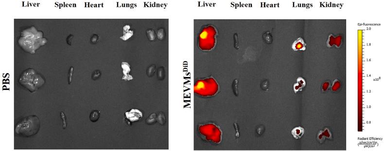 https://cdn.ncbi.nlm.nih.gov/pmc/blobs/969b/11535984/95113d720024/gr3.jpg