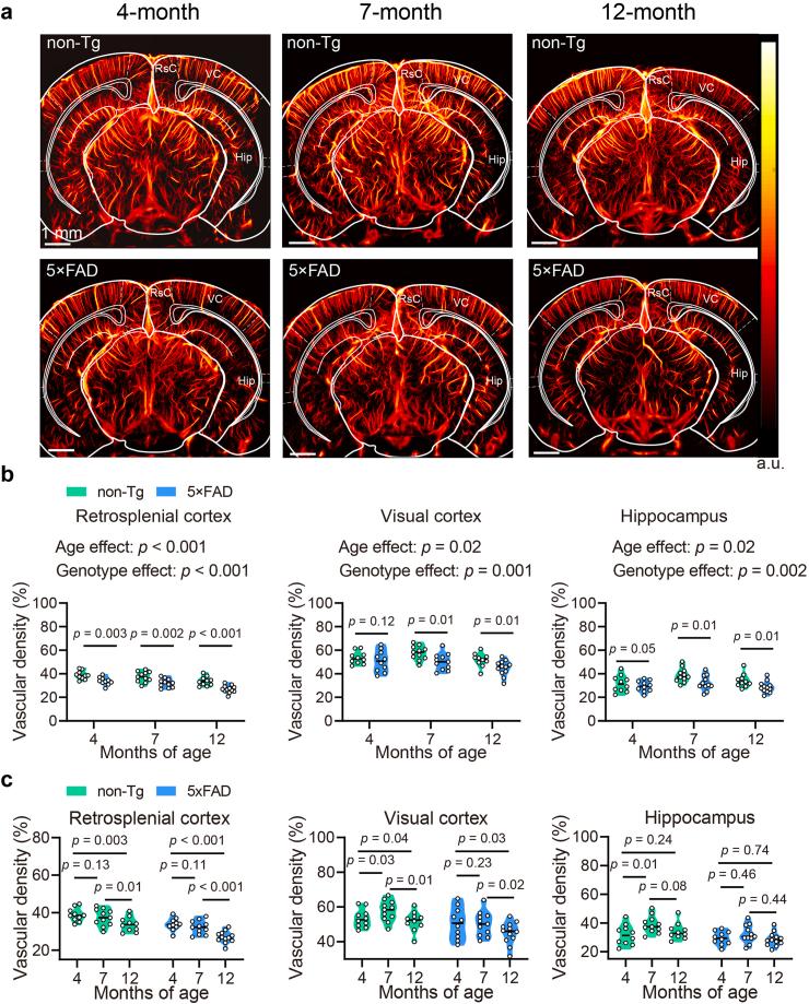 https://cdn.ncbi.nlm.nih.gov/pmc/blobs/96a1/11424966/6a3770d10ff4/gr2.jpg