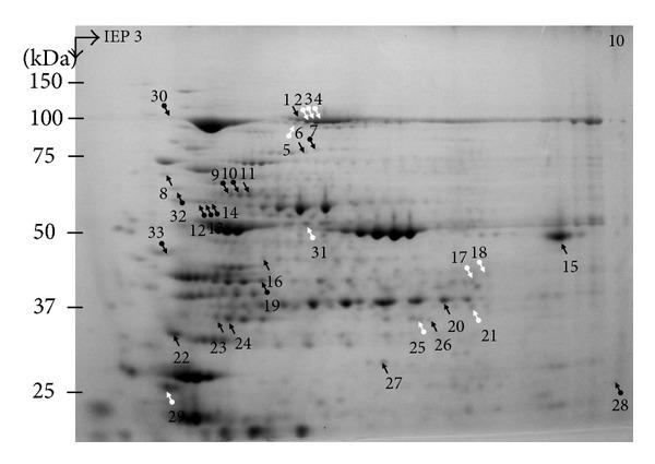 https://cdn.ncbi.nlm.nih.gov/pmc/blobs/96a1/4198819/0afe1d841828/IJPRO2014-395905.002.jpg