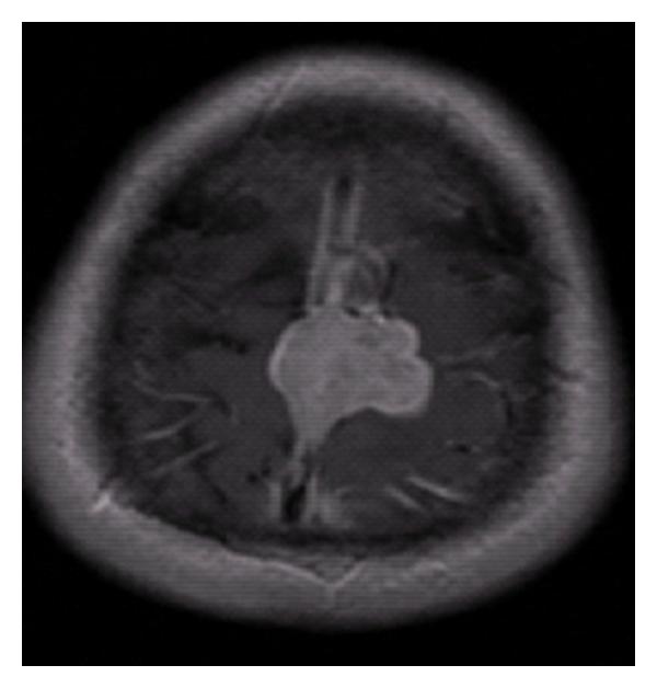 https://cdn.ncbi.nlm.nih.gov/pmc/blobs/96a2/3137955/6cea64a47cf0/SRCM2011-312802.001.jpg