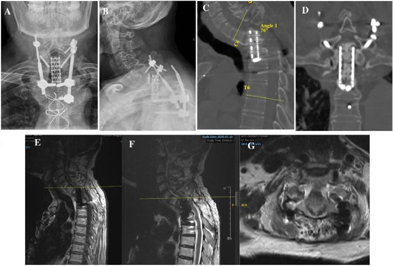 https://cdn.ncbi.nlm.nih.gov/pmc/blobs/96a4/11524943/29acbe2840b4/fsurg-11-1394135-g002.jpg