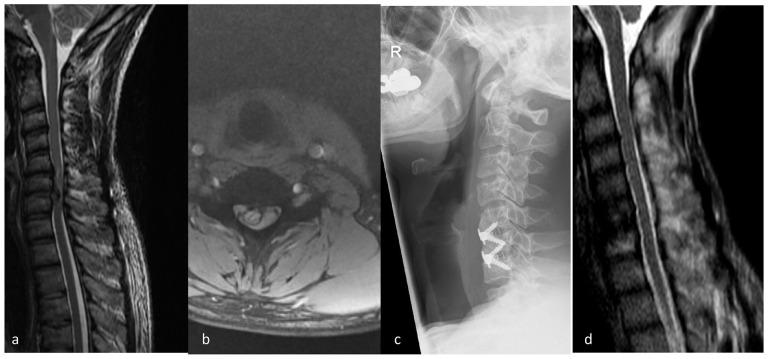 https://cdn.ncbi.nlm.nih.gov/pmc/blobs/96aa/8246101/49c8fbfc753d/eor-6-526-g001.jpg