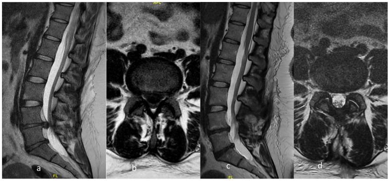 https://cdn.ncbi.nlm.nih.gov/pmc/blobs/96aa/8246101/9fa10be5f2a4/eor-6-526-g003.jpg