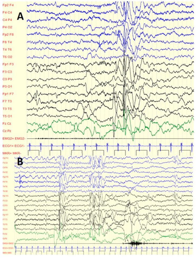https://cdn.ncbi.nlm.nih.gov/pmc/blobs/96b1/9604608/ab8681dbf394/jcm-11-06182-g001.jpg