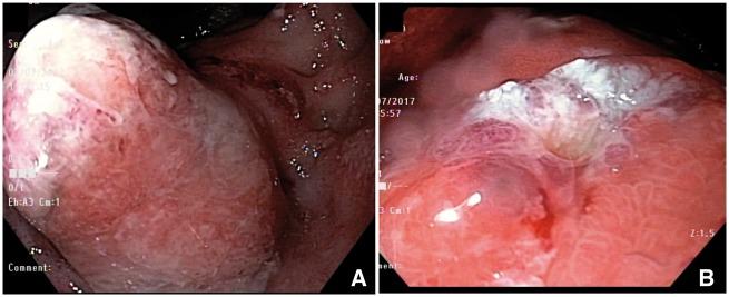 https://cdn.ncbi.nlm.nih.gov/pmc/blobs/96b2/6225829/2c6a27e69133/goy021f7.jpg