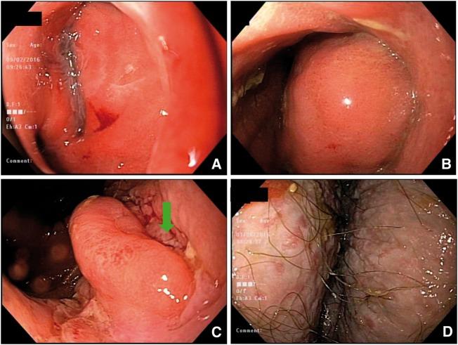 https://cdn.ncbi.nlm.nih.gov/pmc/blobs/96b2/6225829/e7d48865e977/goy021f1.jpg