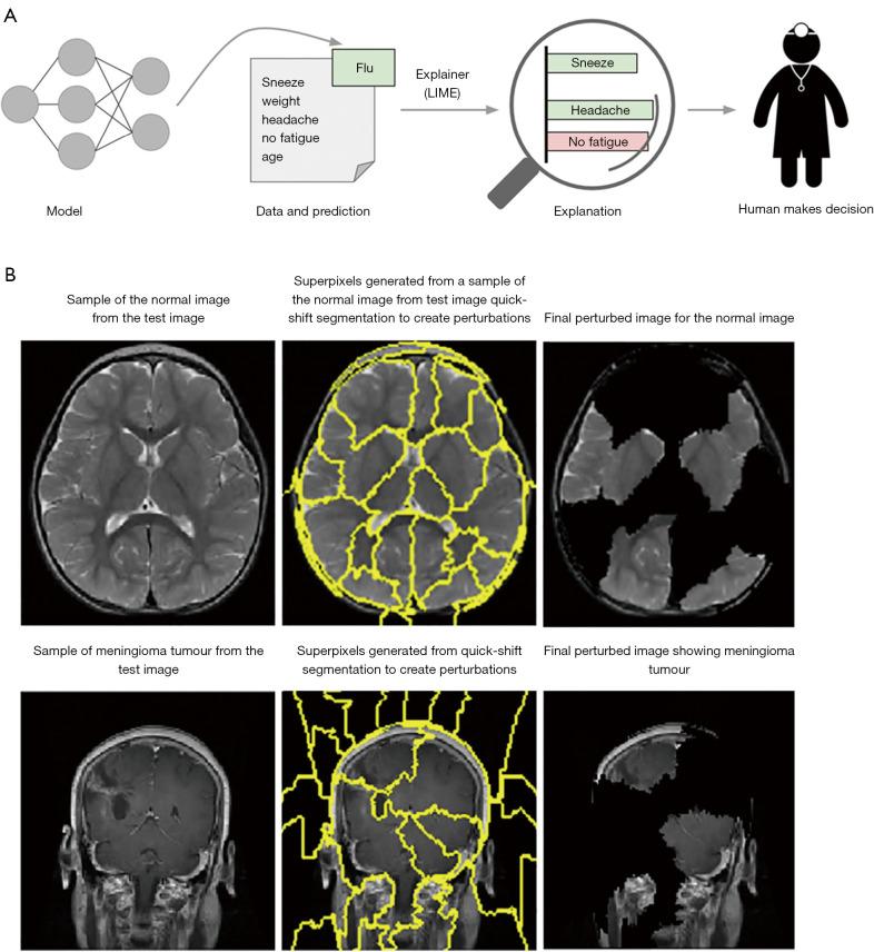 https://cdn.ncbi.nlm.nih.gov/pmc/blobs/96ba/11651983/245eb2aae2d6/qims-14-12-9620-f6.jpg