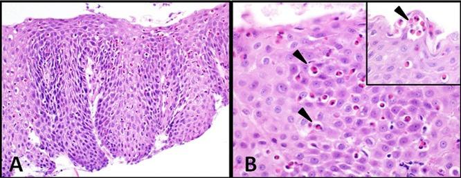 https://cdn.ncbi.nlm.nih.gov/pmc/blobs/96ba/4495666/5f8f9ac8f6ec/postgradmedj-2012-131403f01.jpg