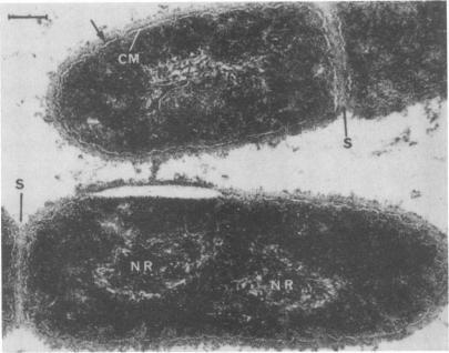 https://cdn.ncbi.nlm.nih.gov/pmc/blobs/96c1/358241/3202640bd4bb/cmr00040-0012-a.jpg