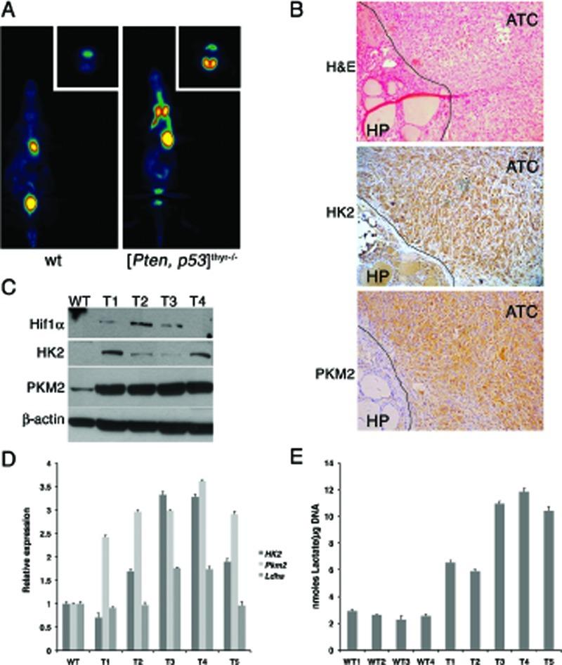https://cdn.ncbi.nlm.nih.gov/pmc/blobs/96ca/3282070/6248b5d11404/oncotarget-02-1109-g008.jpg