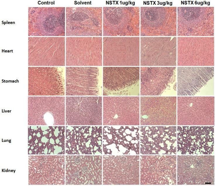 https://cdn.ncbi.nlm.nih.gov/pmc/blobs/96d0/4178483/563fe15dc8a7/marinedrugs-12-05055-g006.jpg