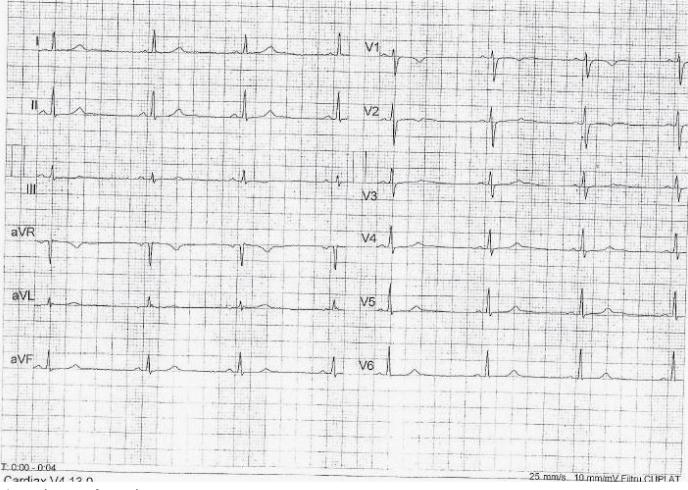 https://cdn.ncbi.nlm.nih.gov/pmc/blobs/96d5/5769906/449693194f08/jccm-03-166-g003.jpg