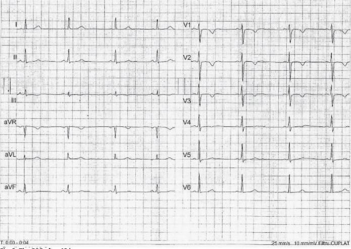 https://cdn.ncbi.nlm.nih.gov/pmc/blobs/96d5/5769906/b20663bd63fd/jccm-03-166-g002.jpg