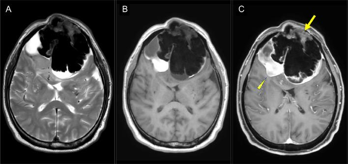 https://cdn.ncbi.nlm.nih.gov/pmc/blobs/96d9/9705602/194d96464d55/gr2.jpg