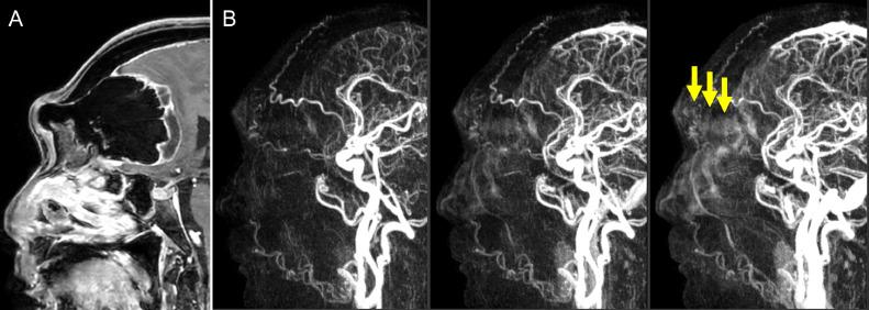 https://cdn.ncbi.nlm.nih.gov/pmc/blobs/96d9/9705602/20edbdb6f94d/gr3.jpg