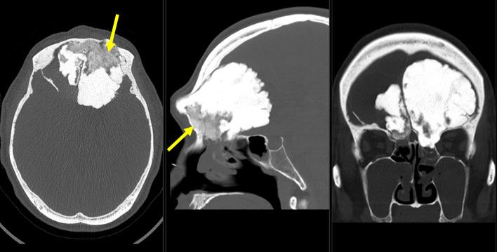 https://cdn.ncbi.nlm.nih.gov/pmc/blobs/96d9/9705602/3a2a3a493f8c/gr1.jpg