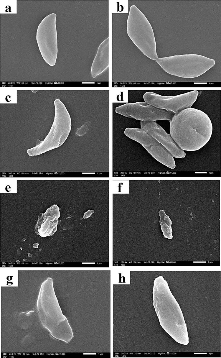 https://cdn.ncbi.nlm.nih.gov/pmc/blobs/96da/10558077/70df4f18b54f/pntd.0011655.g005.jpg