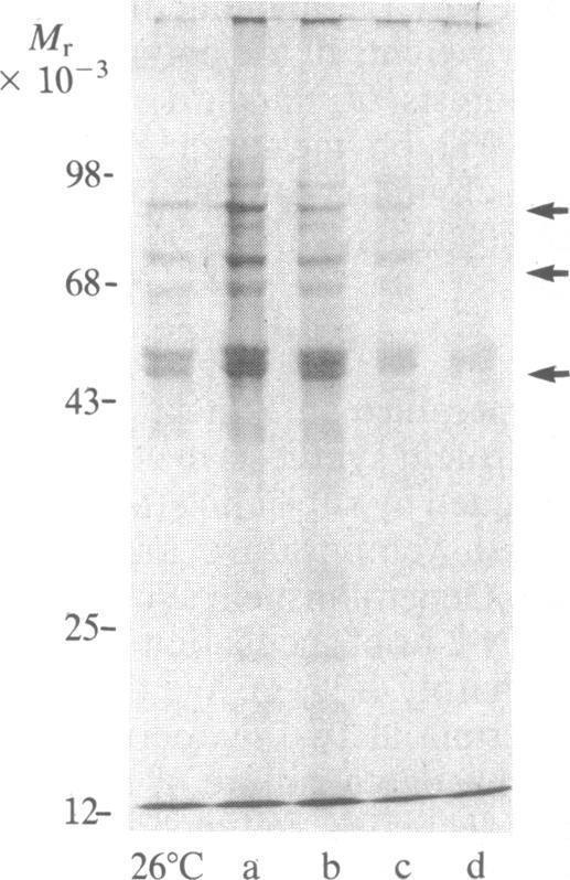 https://cdn.ncbi.nlm.nih.gov/pmc/blobs/96db/391111/b4714e5295c6/pnas00353-0123-b.jpg