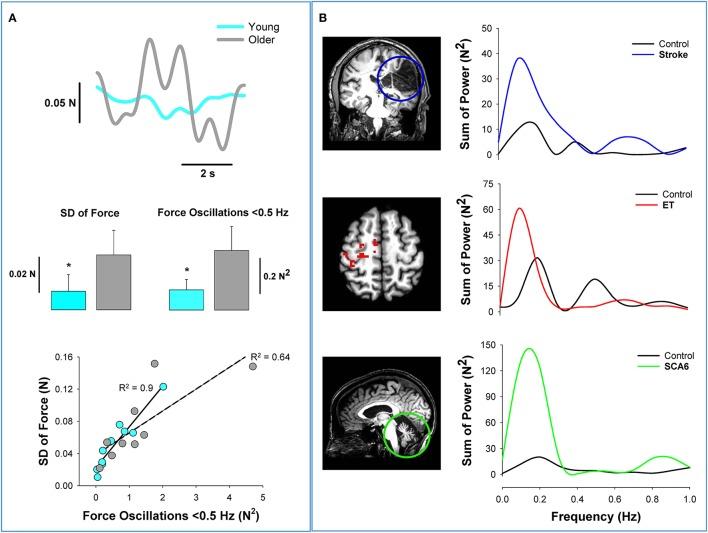 https://cdn.ncbi.nlm.nih.gov/pmc/blobs/96de/5306248/edbd1cc8c3e1/fphys-08-00078-g0002.jpg