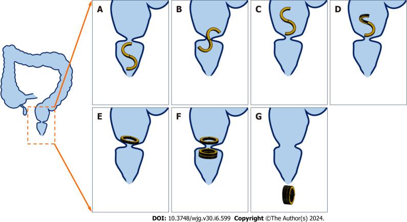 https://cdn.ncbi.nlm.nih.gov/pmc/blobs/96ea/10921145/264794e20fac/WJG-30-599-g002.jpg