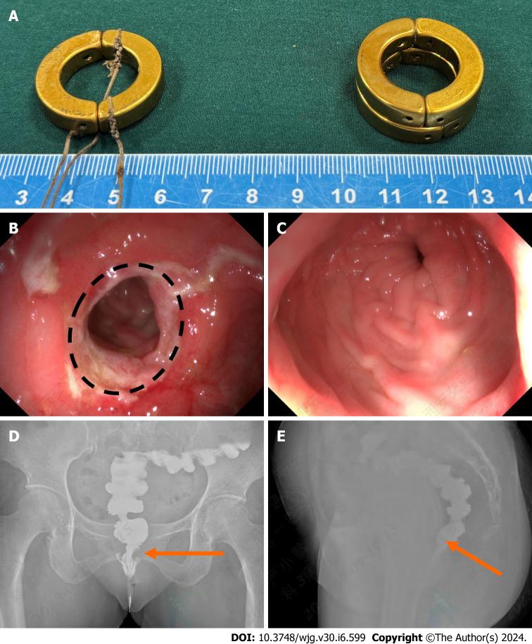 https://cdn.ncbi.nlm.nih.gov/pmc/blobs/96ea/10921145/949e85d93c18/WJG-30-599-g004.jpg