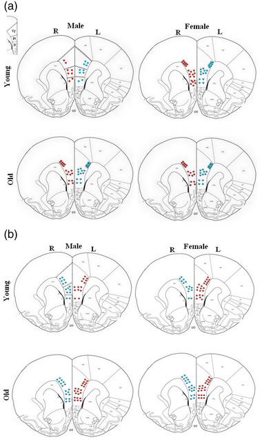 https://cdn.ncbi.nlm.nih.gov/pmc/blobs/96ed/9304845/b5428cfe282e/BRB3-12-e2616-g006.jpg