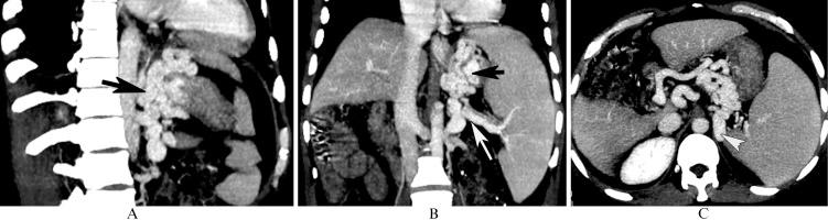 https://cdn.ncbi.nlm.nih.gov/pmc/blobs/9702/3370313/c2573ee8bffe/cln-67-06-609-g002.jpg