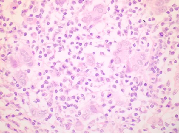 https://cdn.ncbi.nlm.nih.gov/pmc/blobs/9705/2373787/45650851cd67/1477-7800-5-8-1.jpg