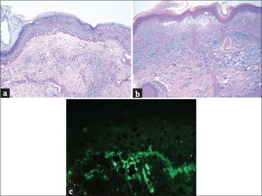 https://cdn.ncbi.nlm.nih.gov/pmc/blobs/9706/10868985/0aa73897f08a/IJD-68-729a-g003.jpg