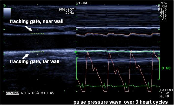 https://cdn.ncbi.nlm.nih.gov/pmc/blobs/9707/6710322/8f1e1058934d/fped-07-00334-g0001.jpg