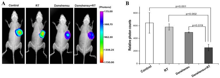 https://cdn.ncbi.nlm.nih.gov/pmc/blobs/970d/5351344/fbc9af560810/ol-13-02-0605-g02.jpg
