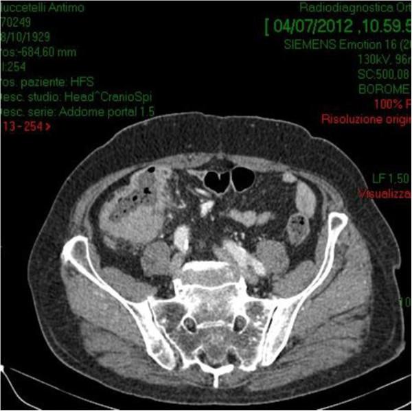 https://cdn.ncbi.nlm.nih.gov/pmc/blobs/970f/4194446/1f93c3f00985/1471-2482-14-75-2.jpg