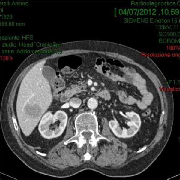 https://cdn.ncbi.nlm.nih.gov/pmc/blobs/970f/4194446/d955db1227e8/1471-2482-14-75-3.jpg