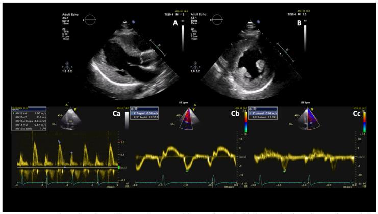 https://cdn.ncbi.nlm.nih.gov/pmc/blobs/9717/7917926/e4dd299e0d99/diagnostics-11-00295-g002.jpg