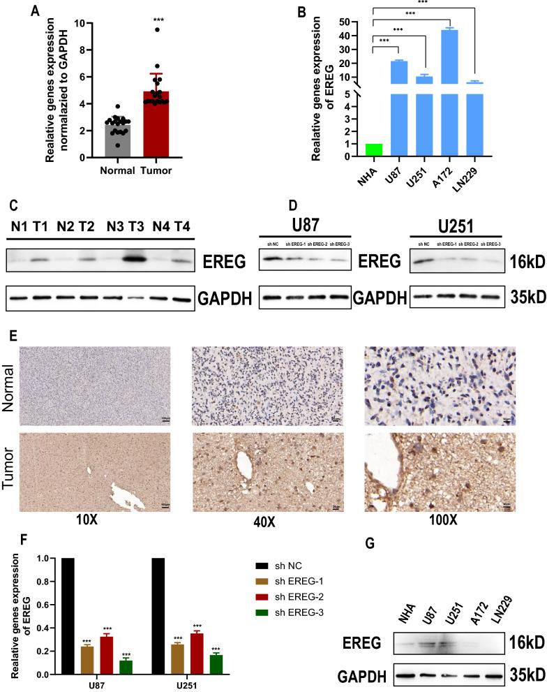 https://cdn.ncbi.nlm.nih.gov/pmc/blobs/971a/9843967/e6edd73a5583/12967_2023_3883_Fig5_HTML.jpg